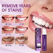 Crema Morada Blanqueador Dental